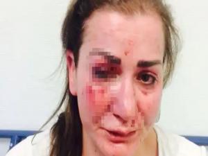Almanya'da Türk kadına tramvayda saldırı