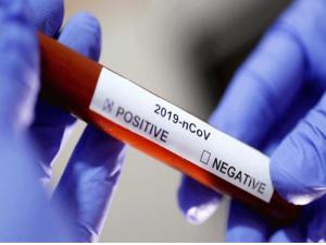 Çek Cumhuriyetinde ilk yeni koronavirüs tespit edildi